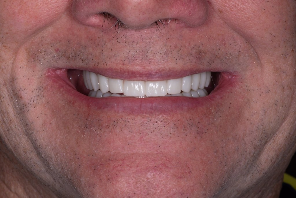 Close-up of a smile with beautiful teeth. 