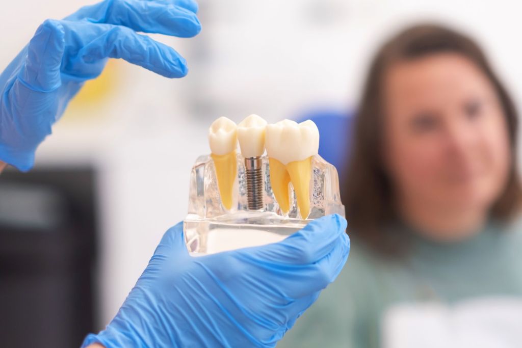 A dentist showing a diagram of jaw and dental implant